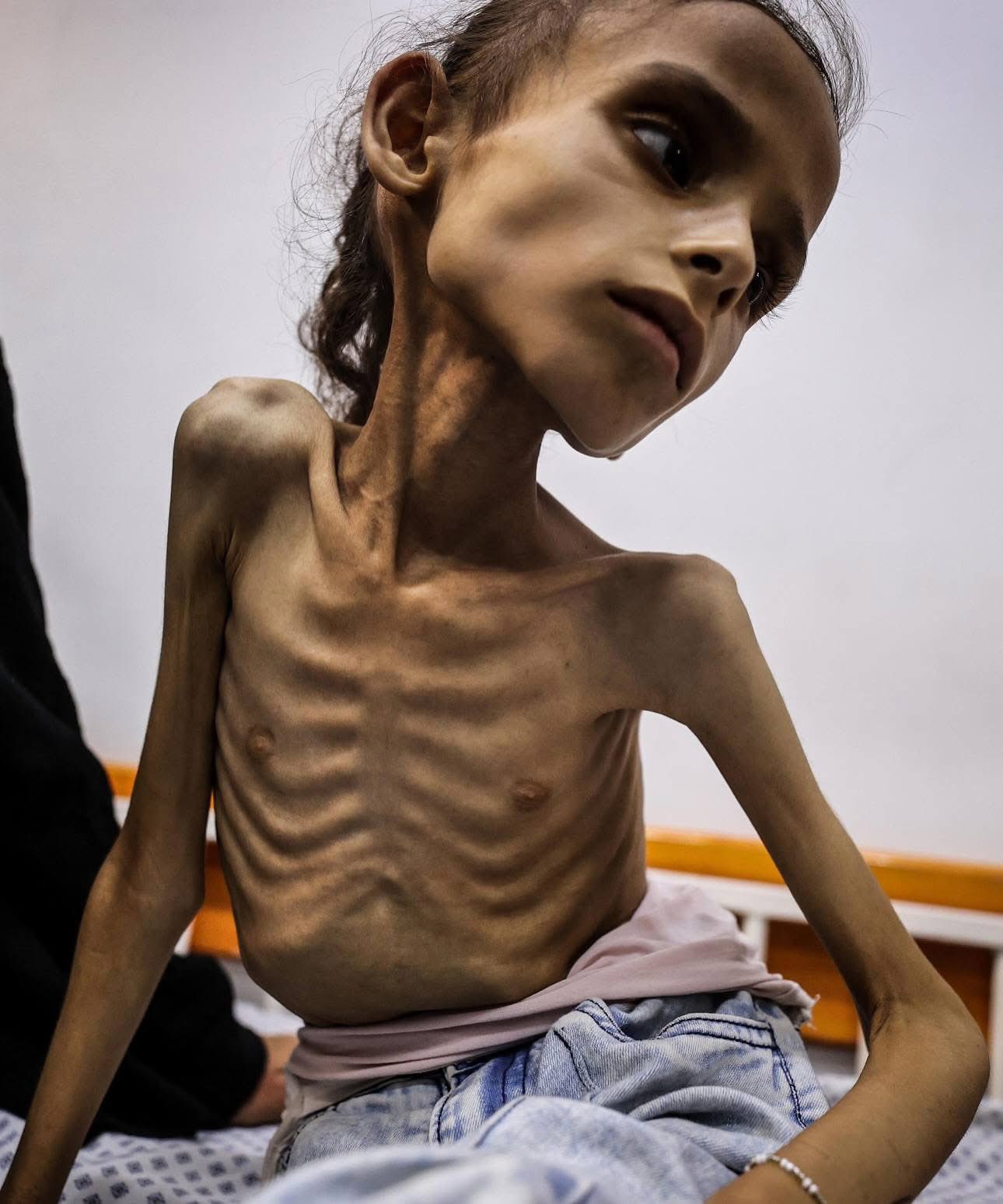 Eight Malnourished Deaths Reported; Starvation Death Toll Reaches 188