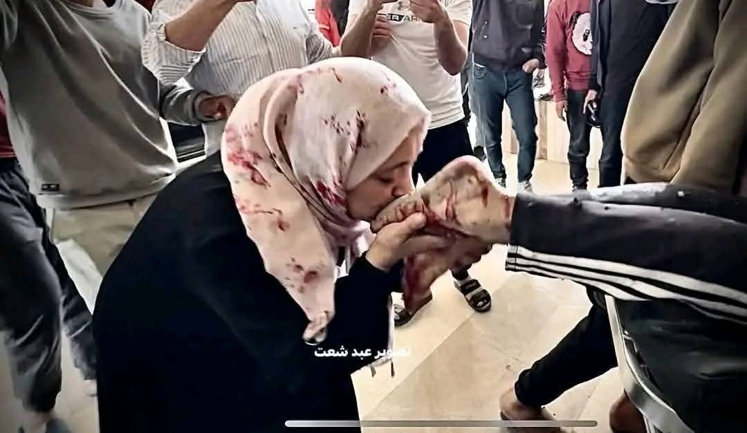 Mother kisses wounded groom son before wedding Gaza