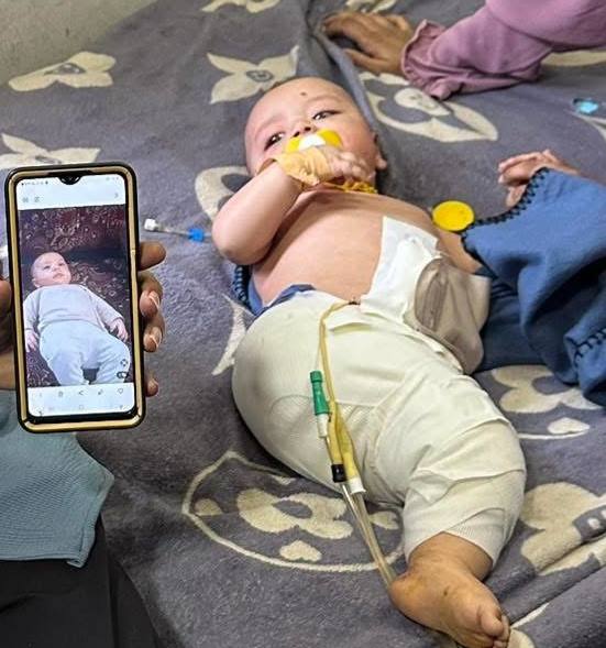 Critical injuries to 4-month-old infant in Gaza airstrike