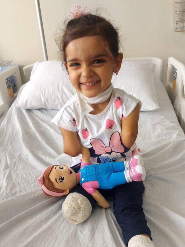 Israeli soldier amputates child’s arms, she still smiles