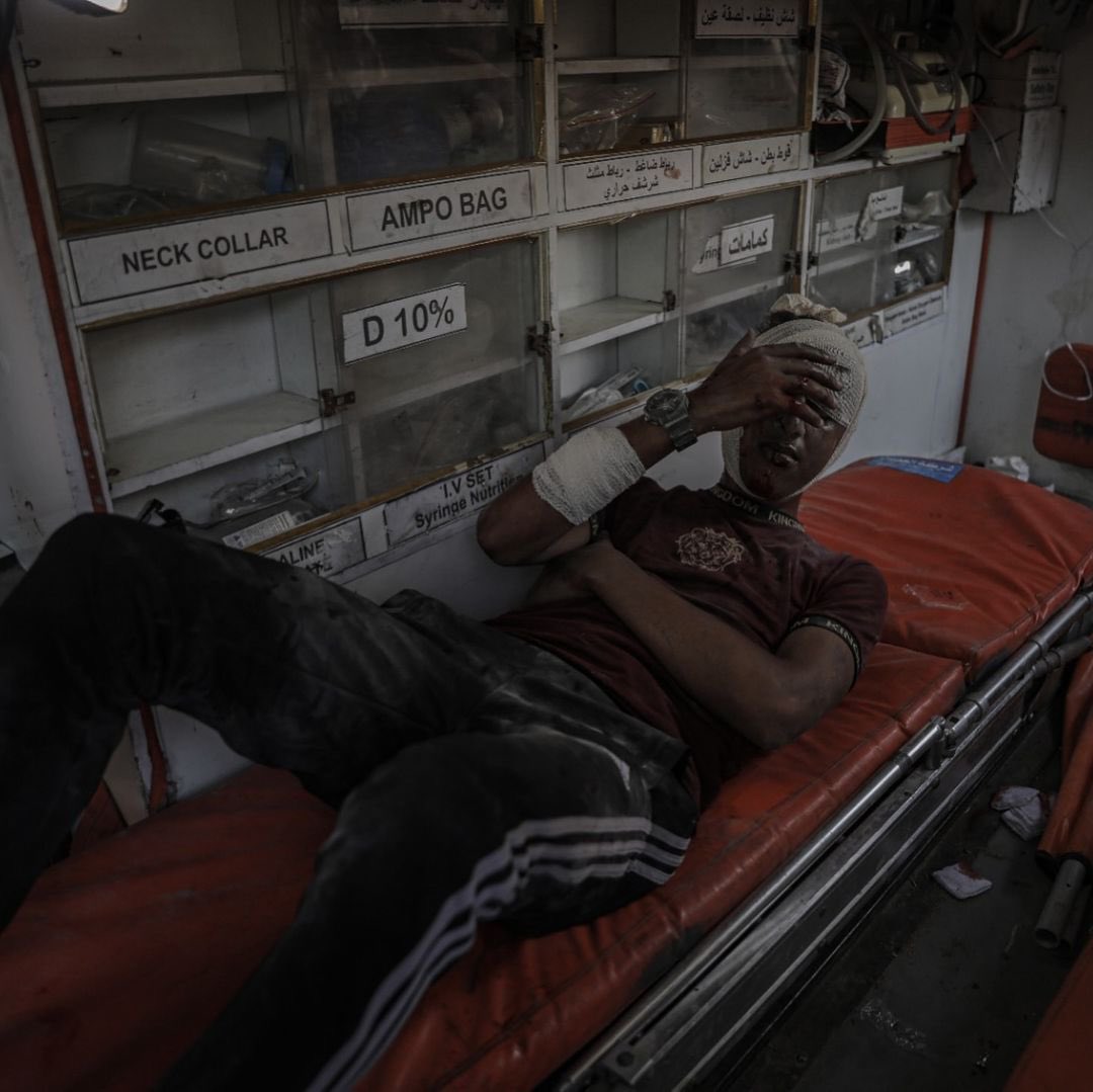 Al-Aqsa Hospital Injuries from Israeli Airstrikes Gaza