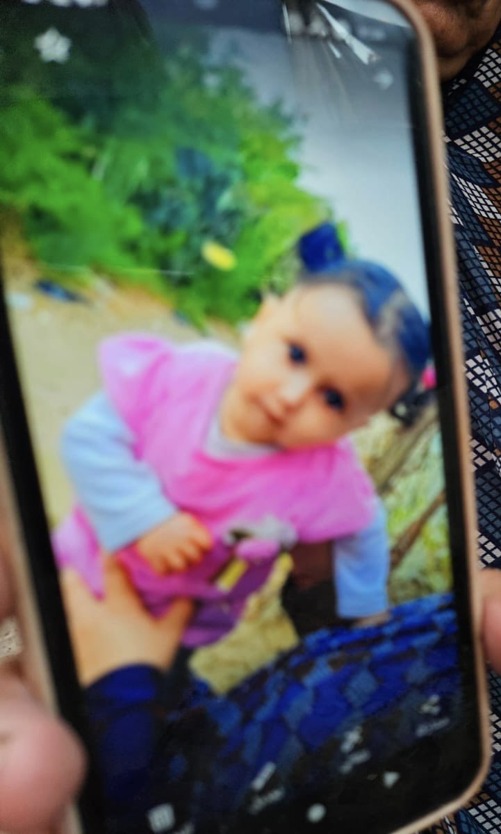 Child with Scleroderma Needs Urgent Medical Treatment and Care