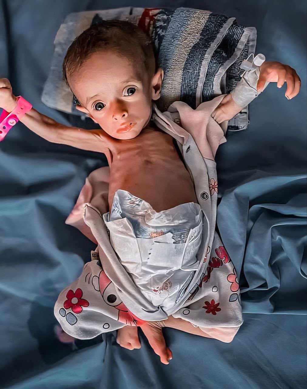 Gaza infant mortality crisis from humanitarian blockade