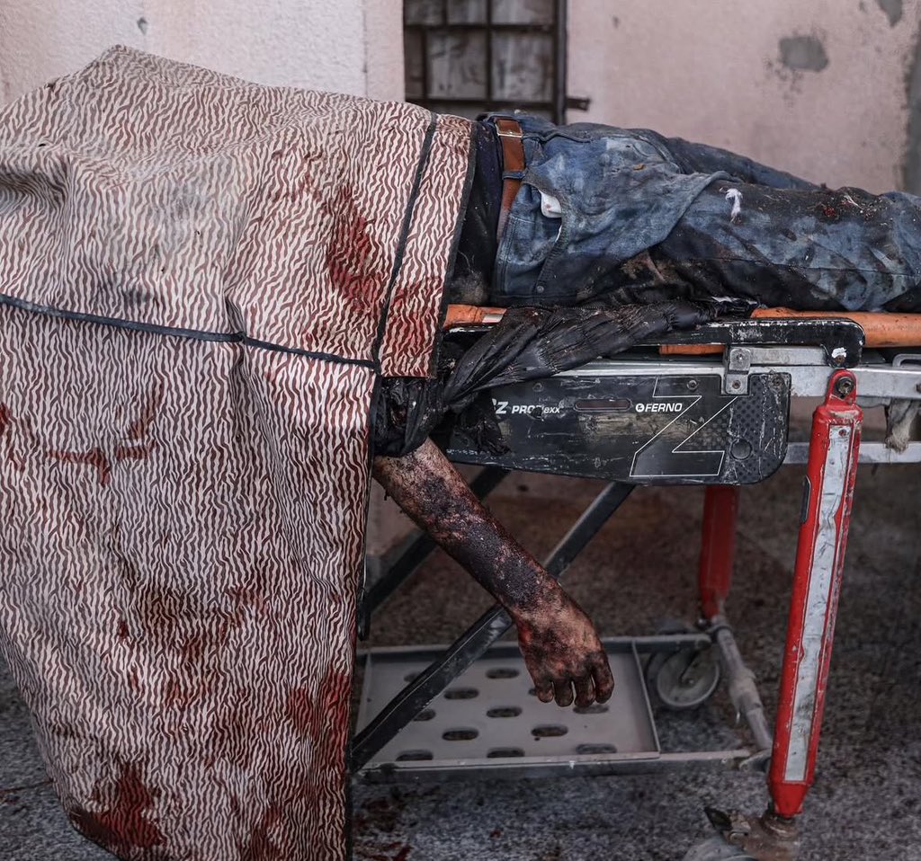 Israeli forces kill 17, wound 58 in Gaza Strip in 24 hours