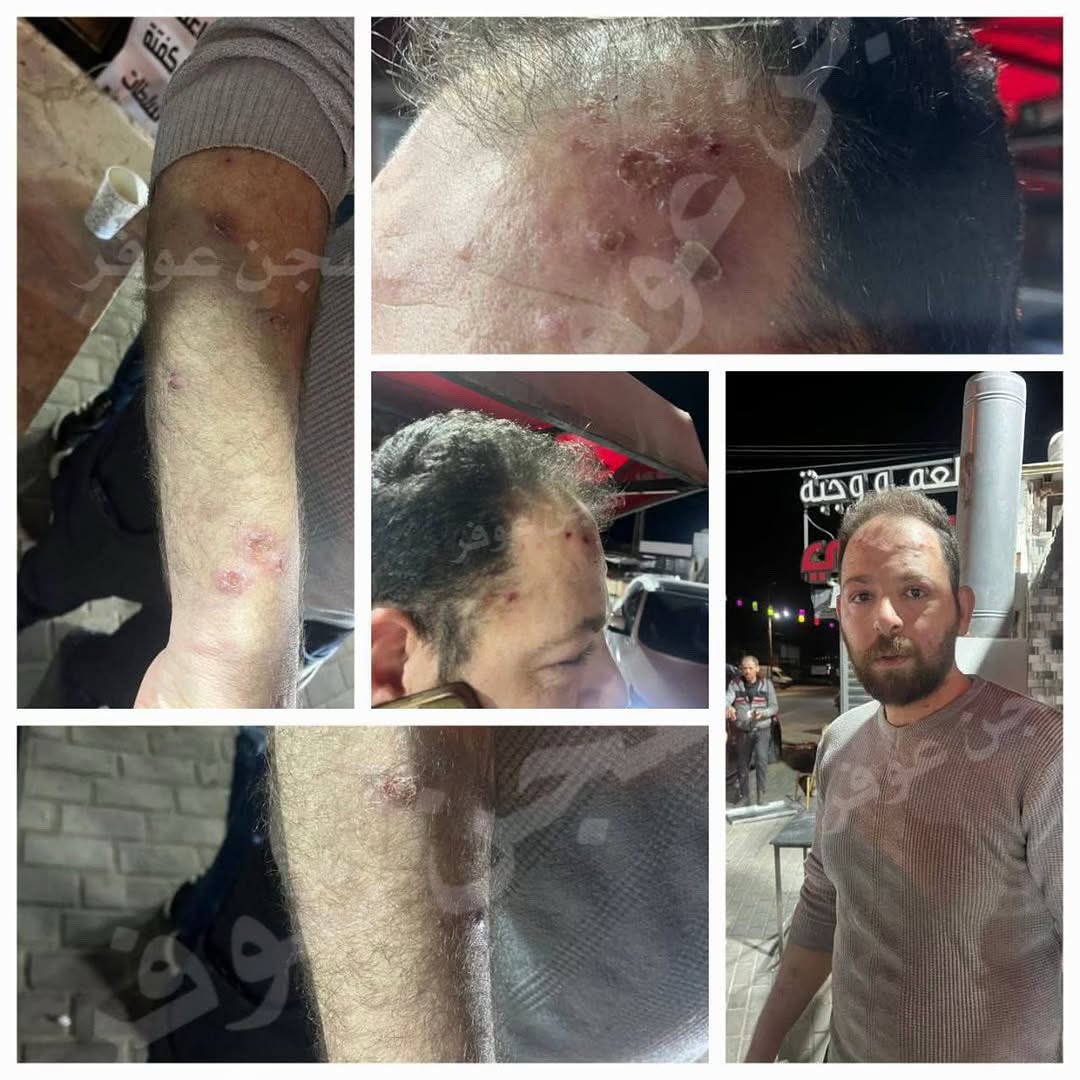 Prisoner Released After Torture at Jalameh Interrogation Center