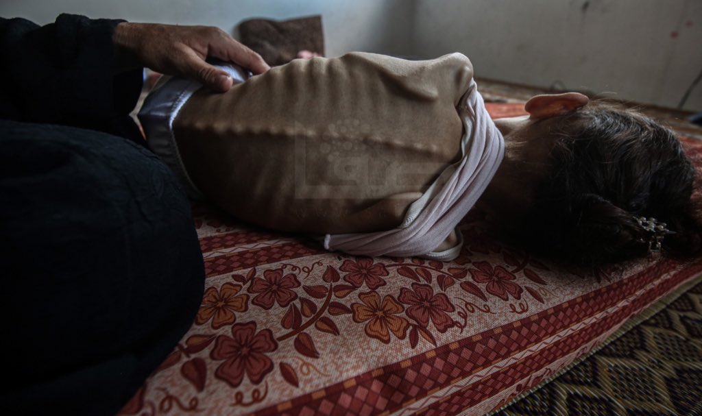Five Deaths from Hunger Reported; 180 Total Deaths
