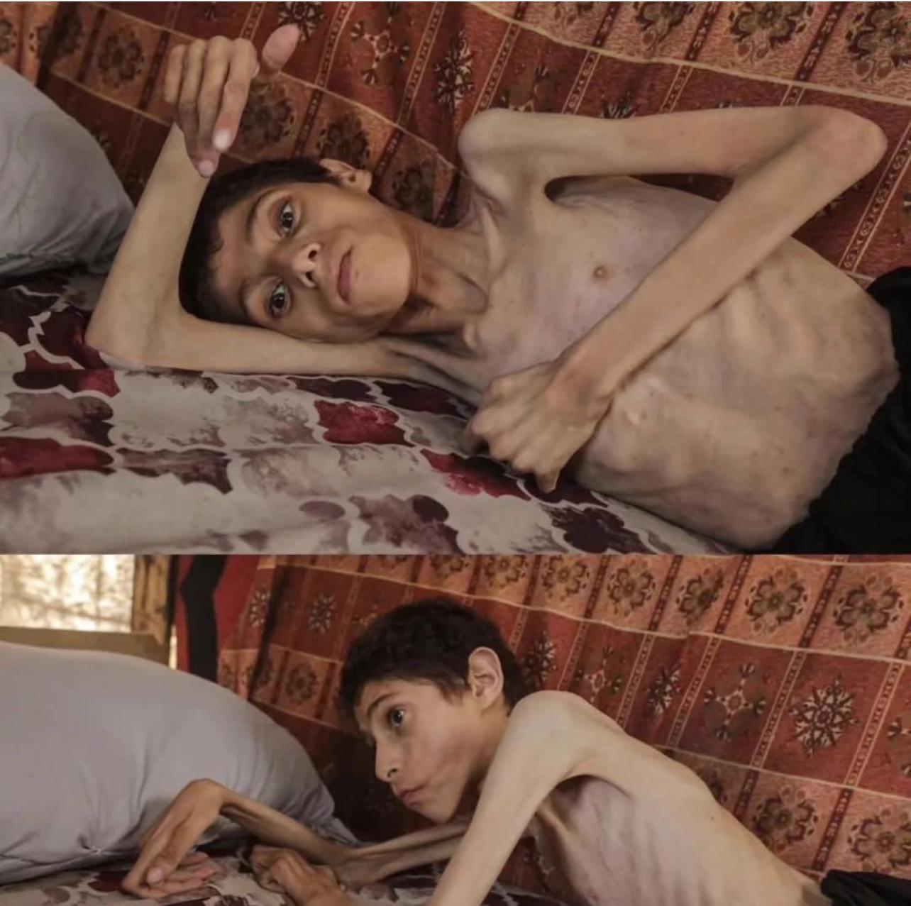 Israel accused of using starvation as war crime tactic in Gaza