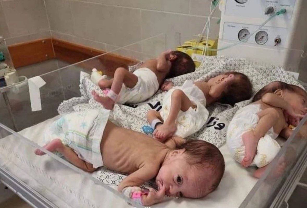 Gaza Starvation Crisis: Genocide Through Forced Hunger