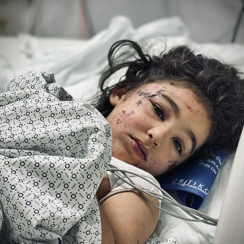 7-year-old Aseel Musameh injured and awaiting treatment abroad