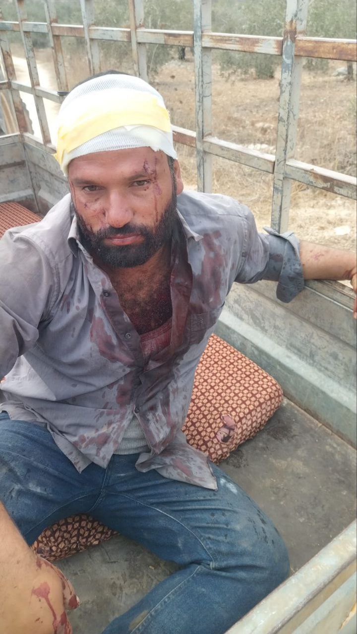 Settler attack injures two near Beit Lid east Tulkarem