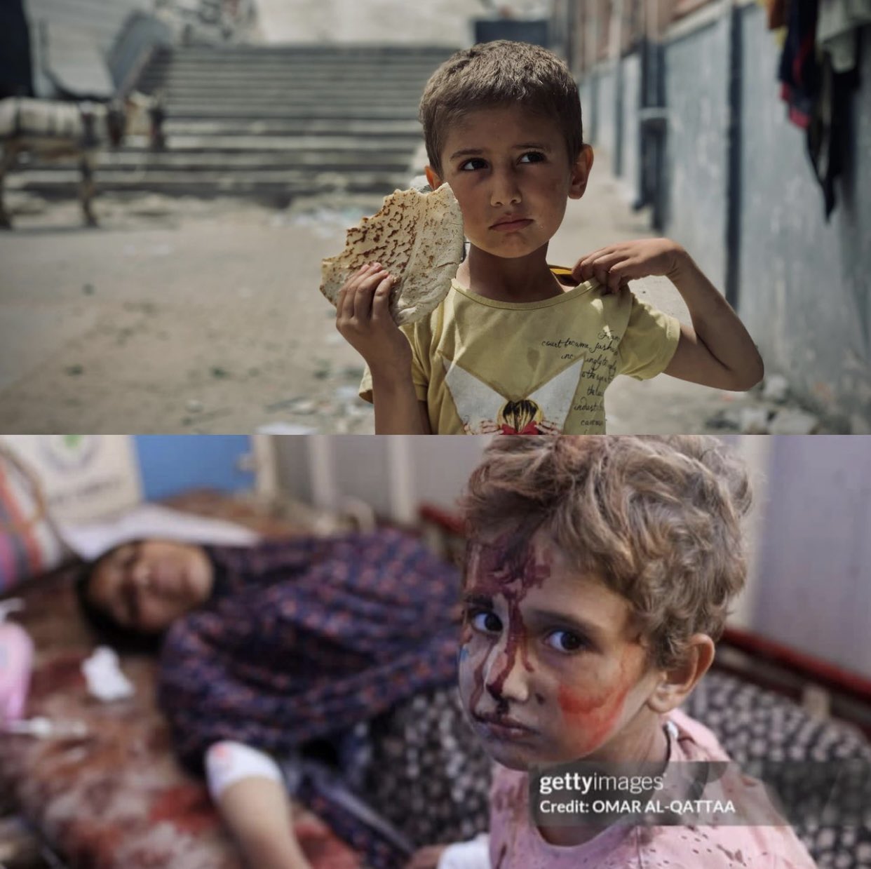 Child’s conditions in Israeli military displacement shelter documented