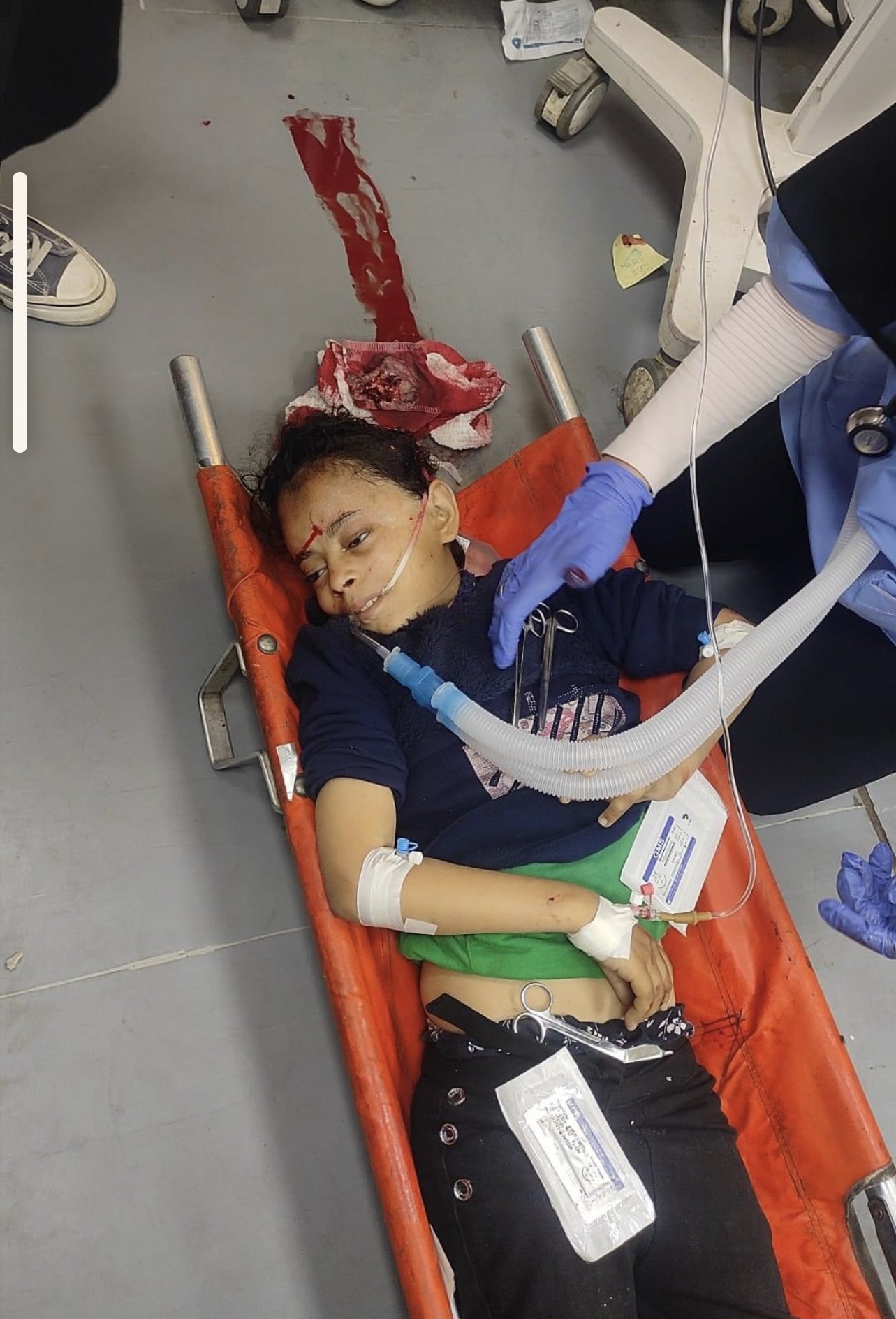 Israeli Forces Bombardment Gaza Casualties Report