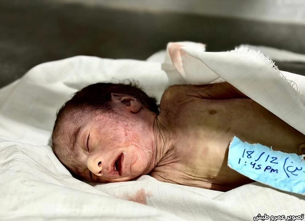 Child Saeed Abdeen dies from extreme cold in tent