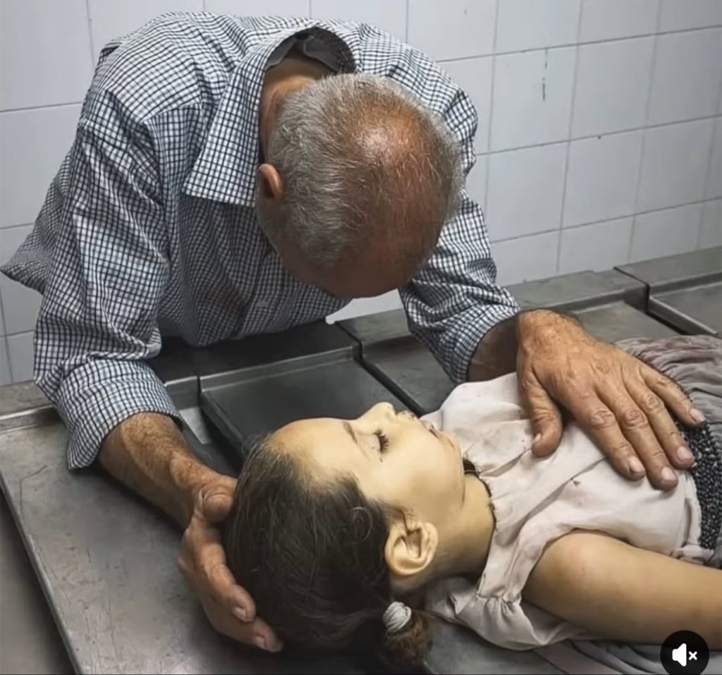 Malnutrition crisis among children and pregnant women in conflict zone