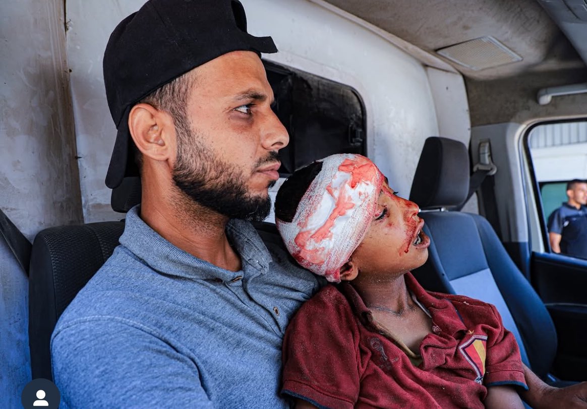 UN Reports Critical Food Crisis and Deaths in Gaza