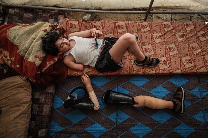 12-year-old Gaza amputee returns after prosthetic treatment