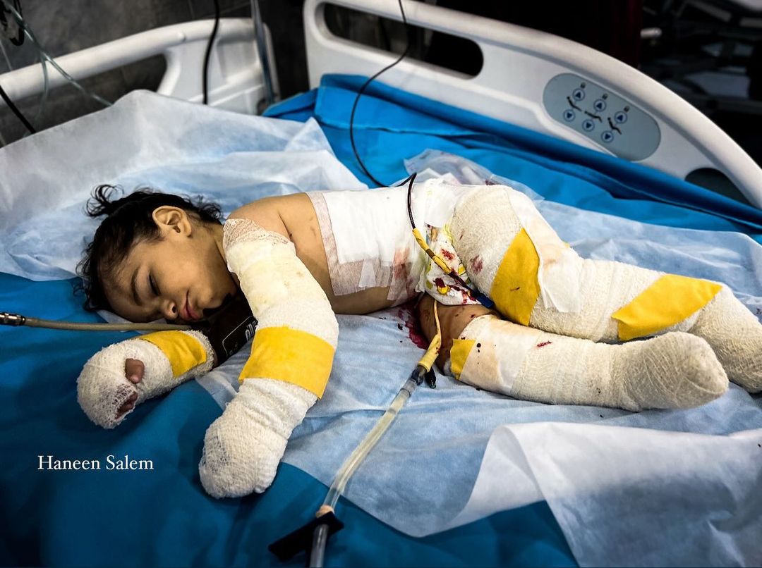One-year-old Palestinian child Omar fights for life after Al-Taba’een massacre