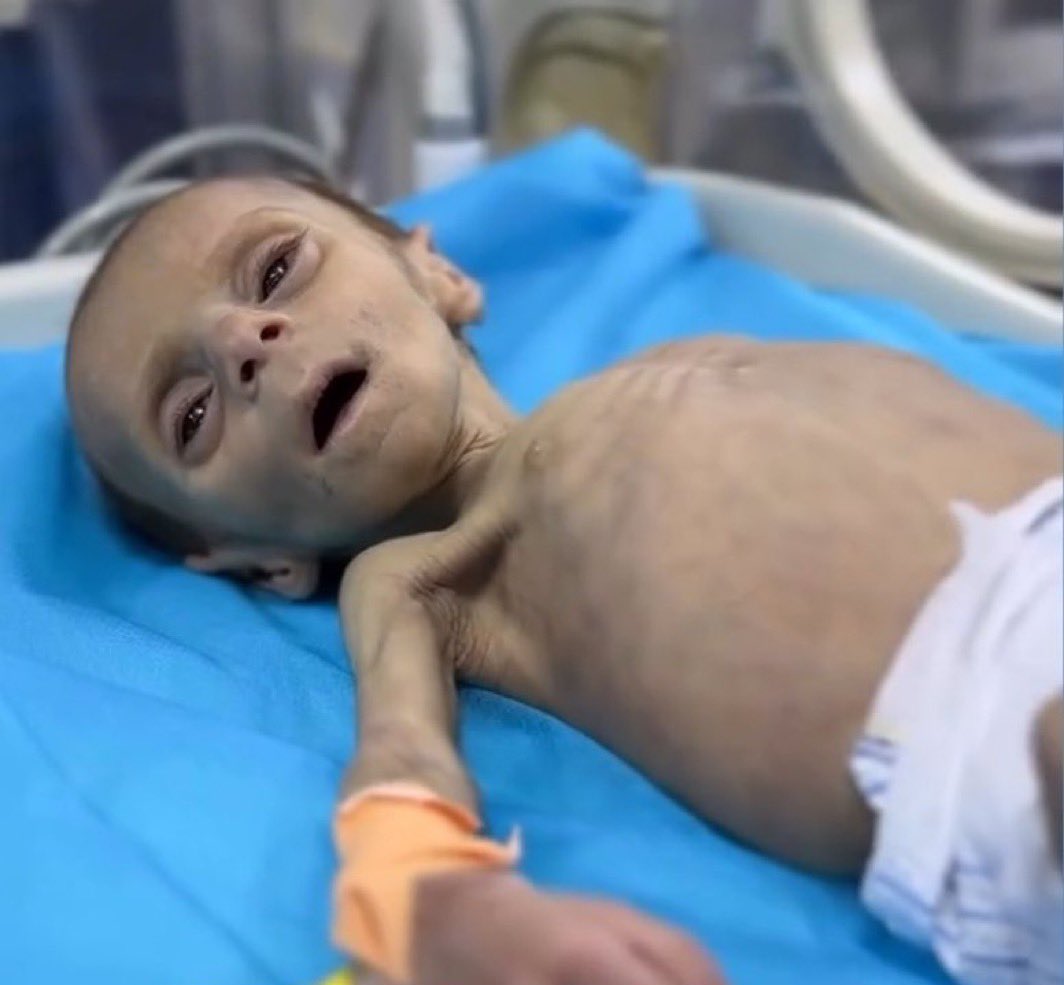 Gaza 2025: World Remains Silent on Ongoing Crisis
