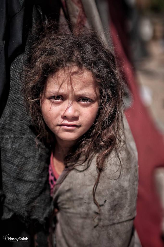War’s Impact: Children’s Faces Marked by Pain and Fear