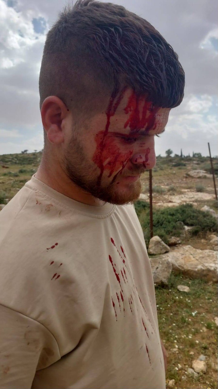 Israeli settlers attack Palestinians in Masafer Yatta