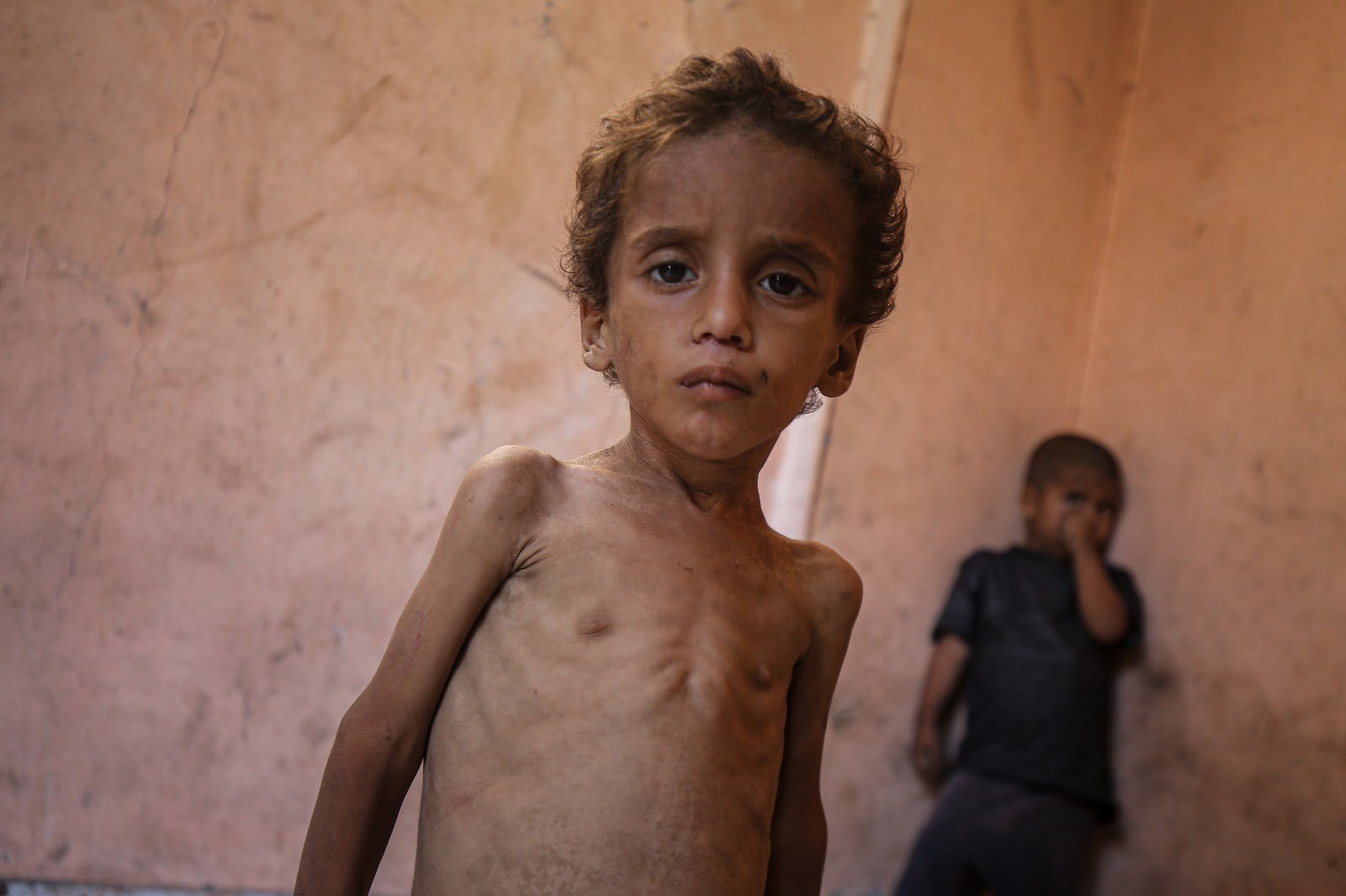 Malnutrition crisis in besieged Gaza Strip