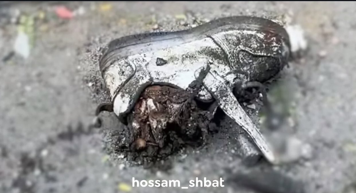 Child casualty from Israeli bombing in Gaza