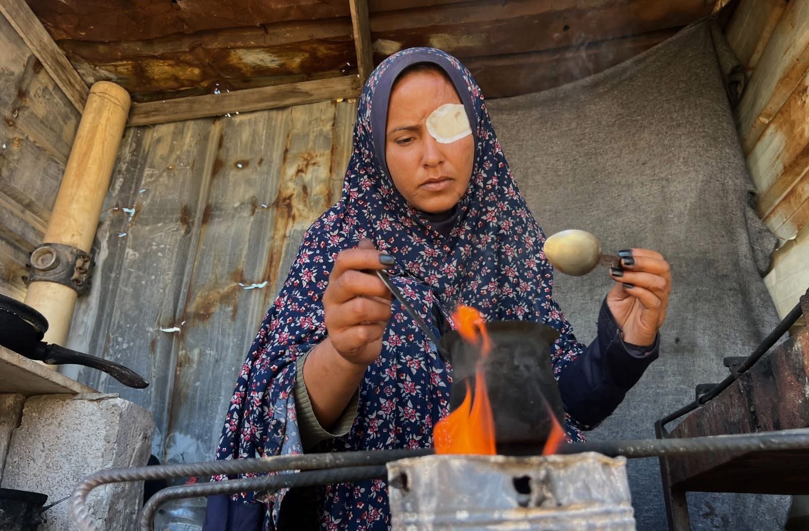 Gaza survivor loses eyesight, displaced after airstrike destroys home