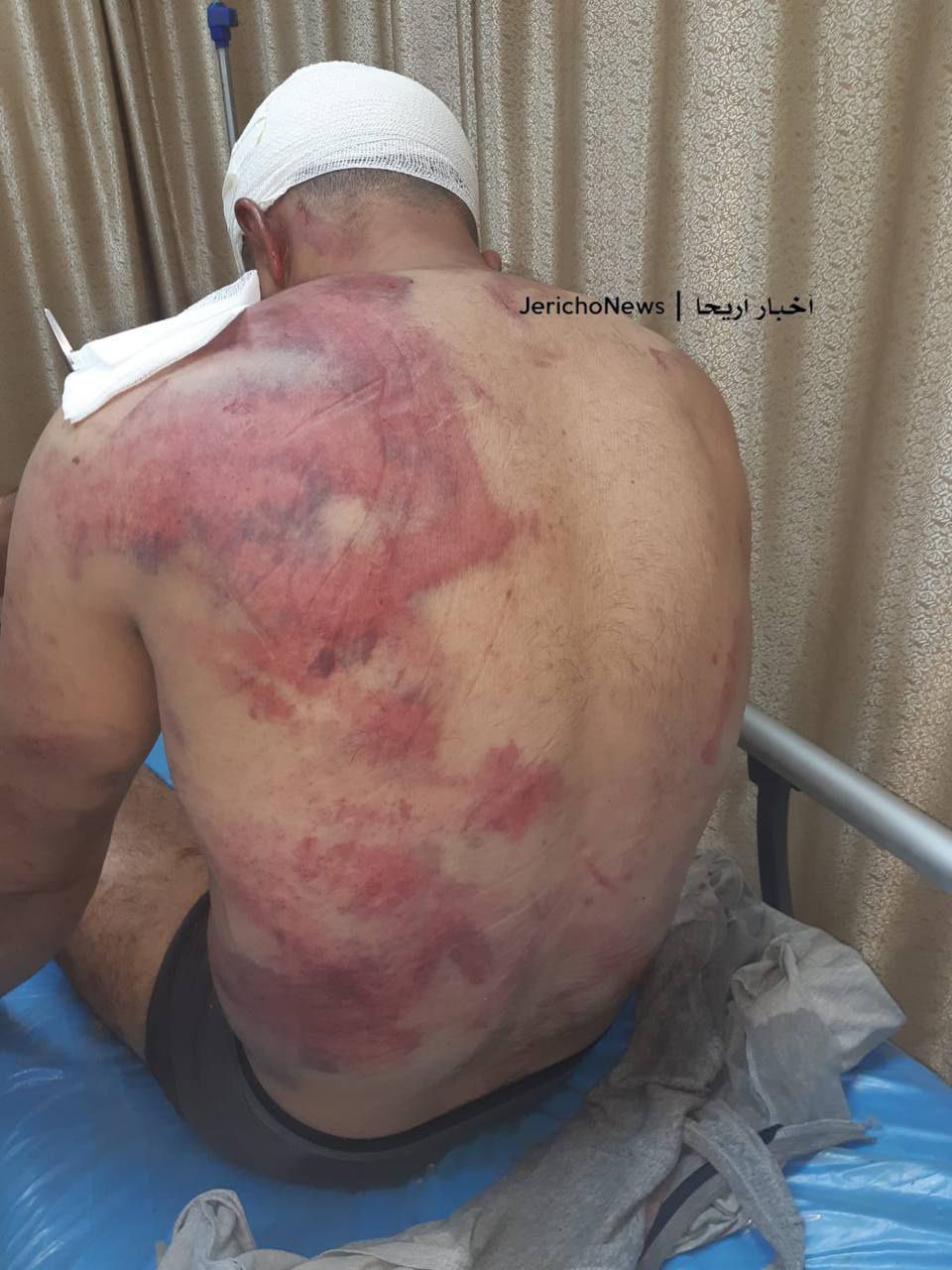 Israeli settlers abduct and torture Palestinian man in Jericho