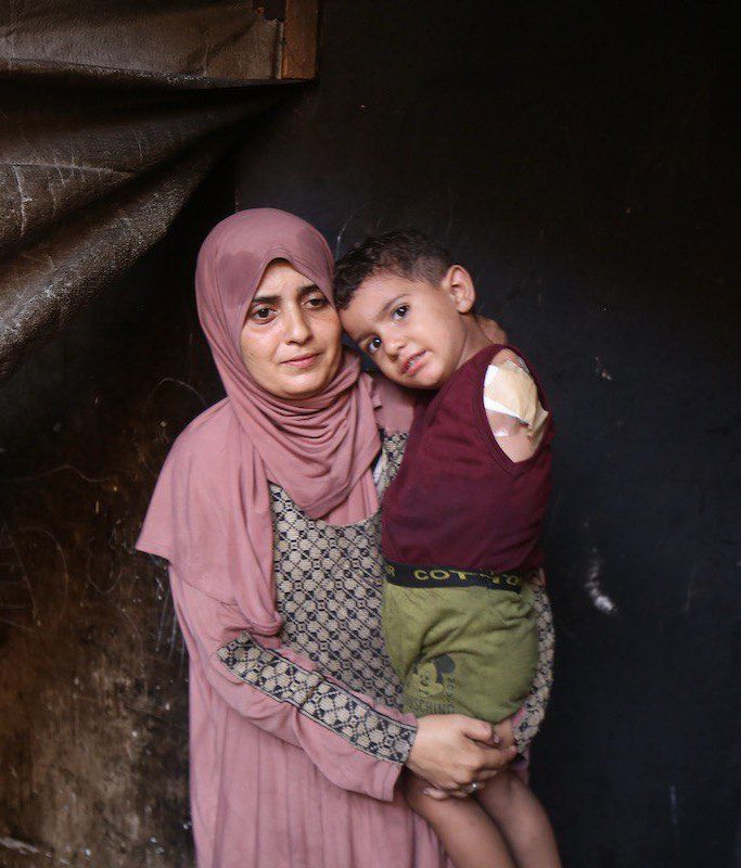 Netanyahu’s army inflicted harm on Gaza baby