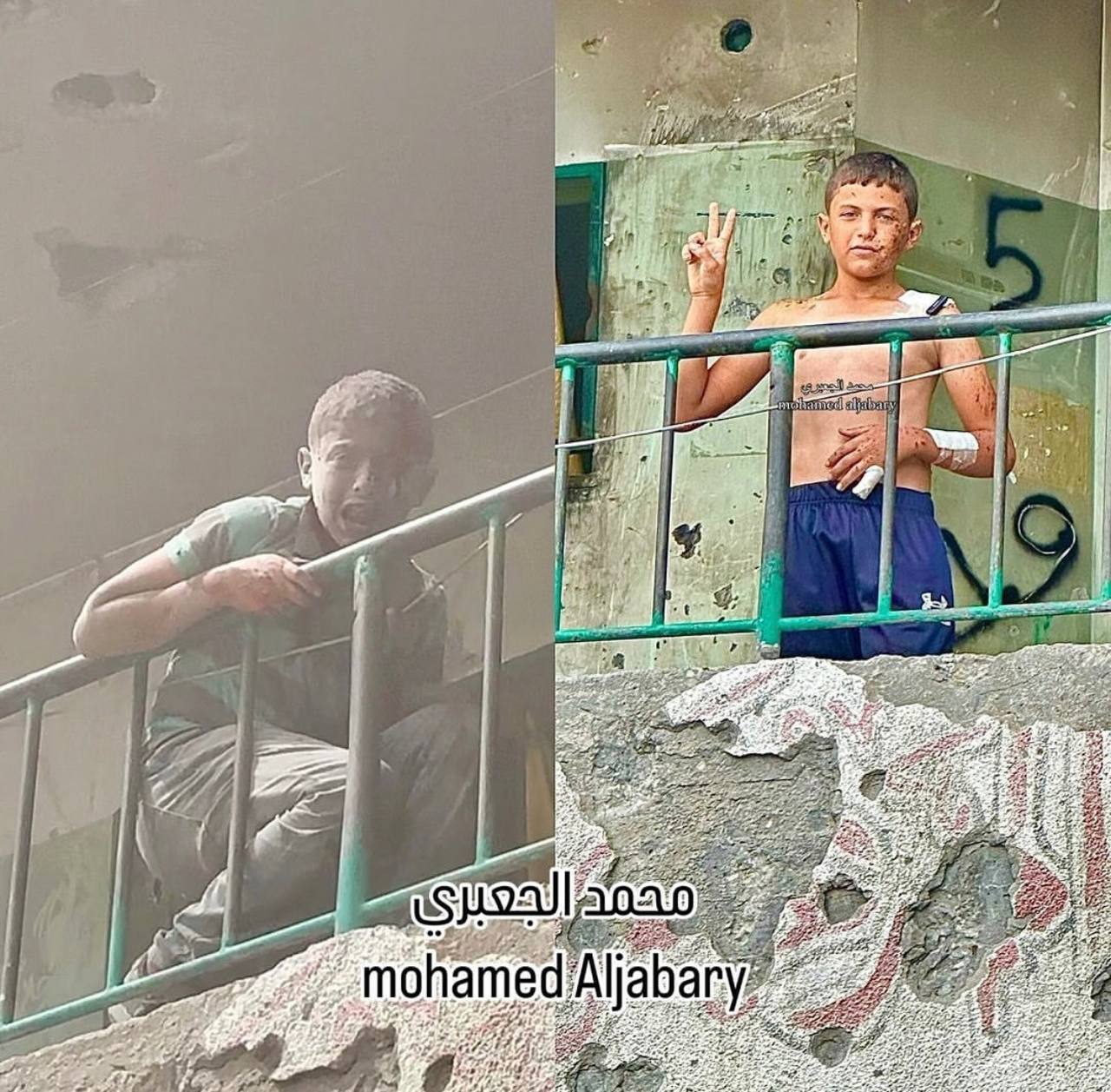 Palestinian child Musab Al-Mubayed recovers after school bombing
