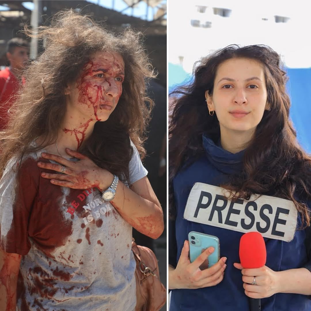 Palestinian Journalist Wounded in Israeli Strike on Gaza Beach Cafe