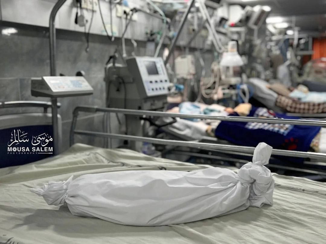 Baby Mohammad dies at Gaza hospital from hunger