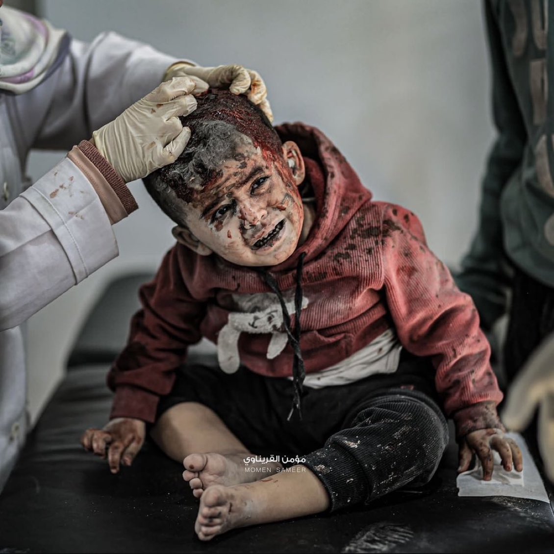 Israeli forces kill 31, wound 57 in 24 hours