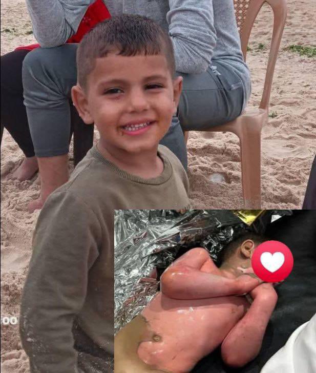 Child injured in stampede at Al Nuseirat refugee camp