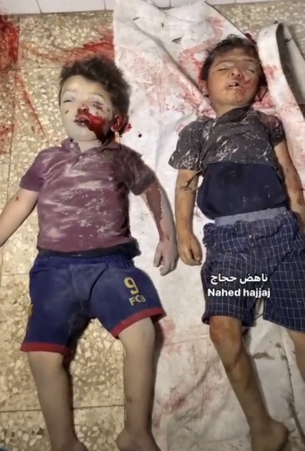 Gaza casualties reported overnight Israeli bombing
