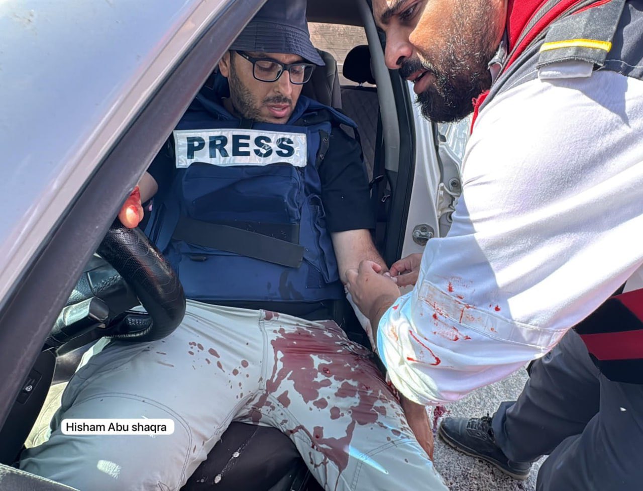 Red Crescent treats journalists injured by shrapnel in Jenin