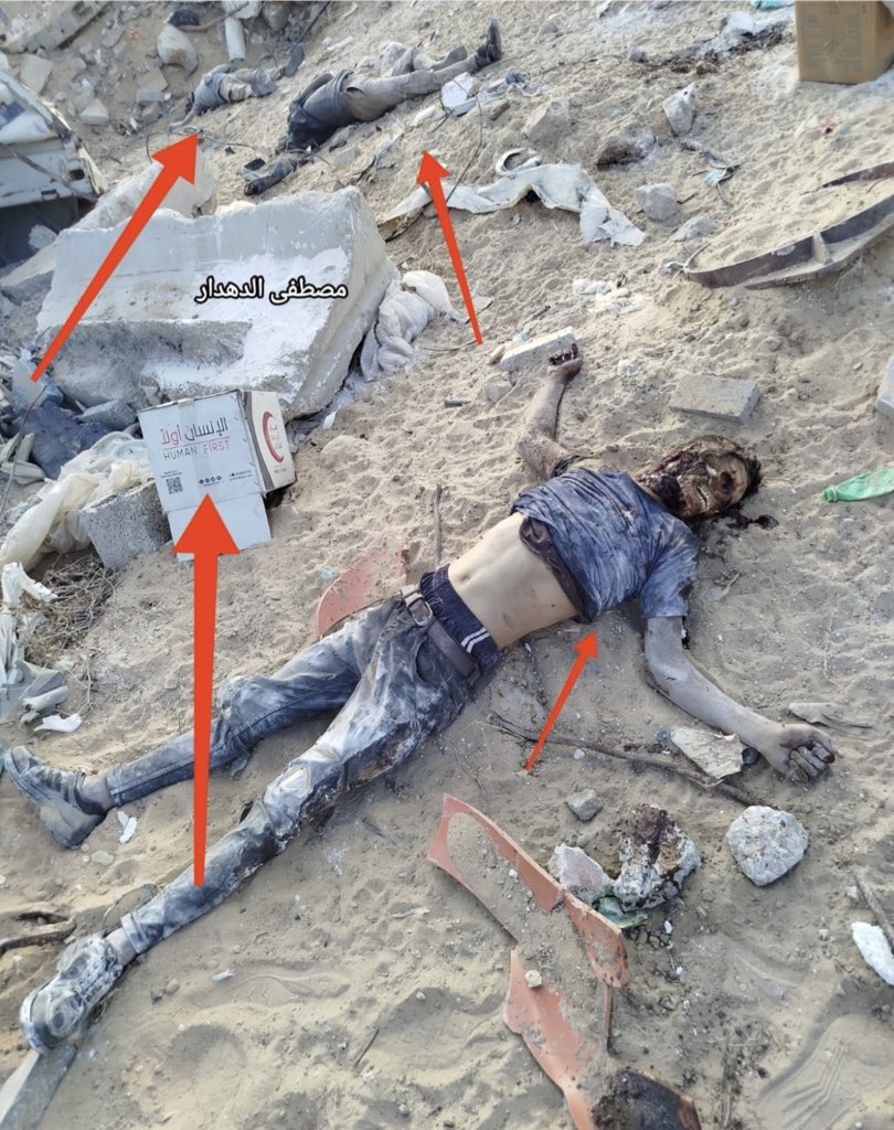 Three Gaza victims killed by hunger amid Israeli-enforced famine
