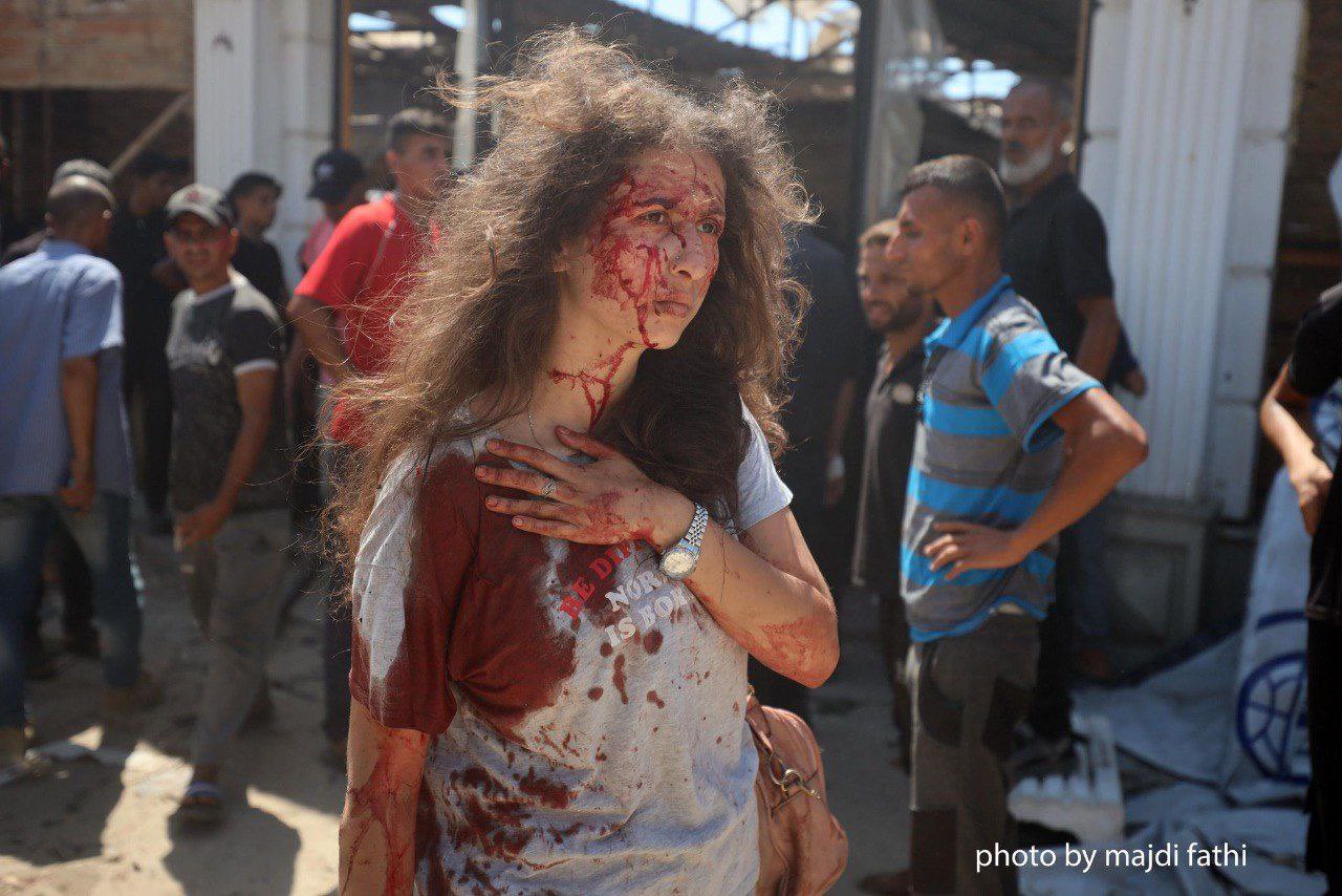 Journalist Bayan Abu Sultan injured in Israeli airstrike Gaza beach