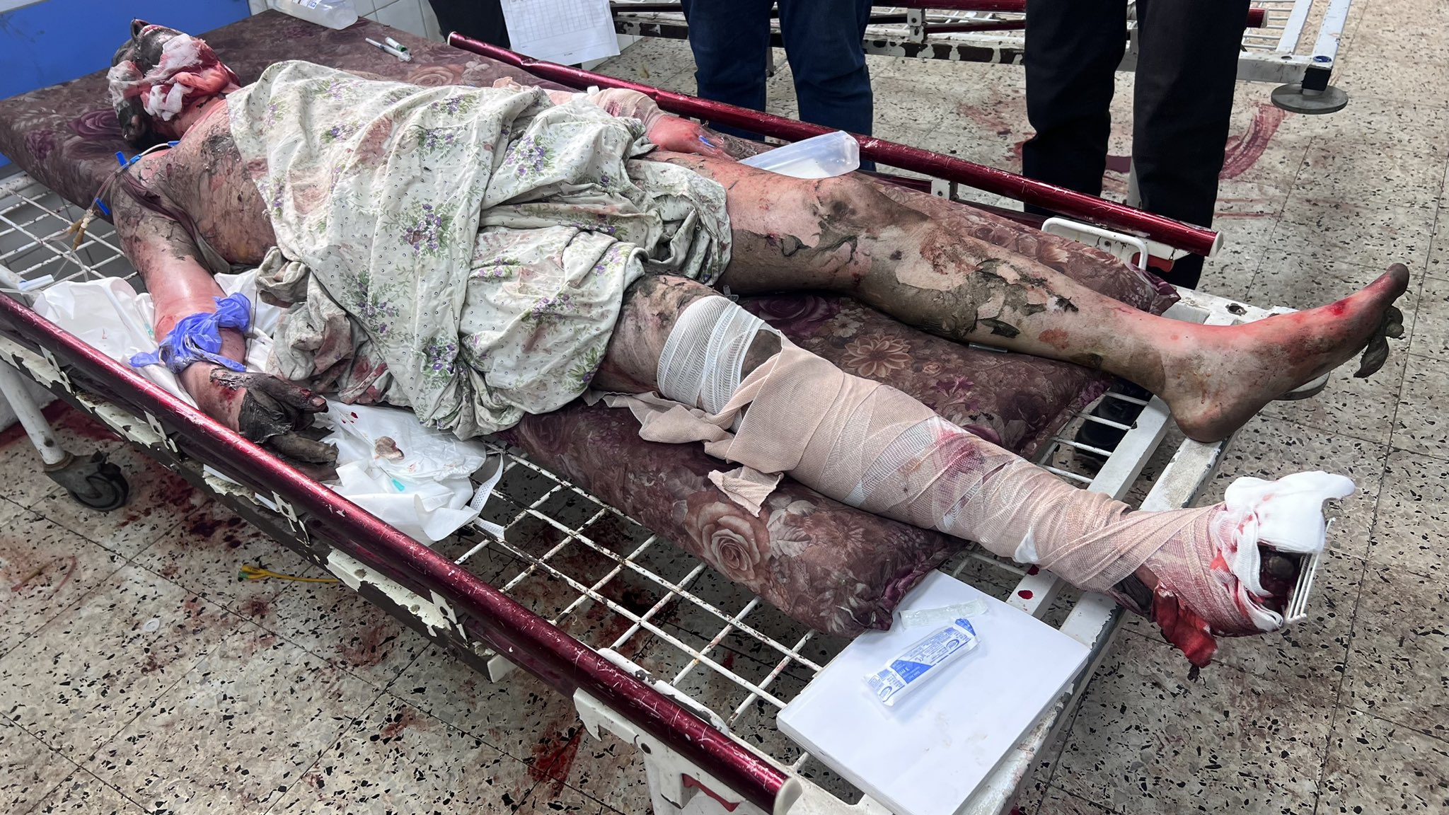 Alleged Unusual Weapons in Al Tab’een Mosque Massacre