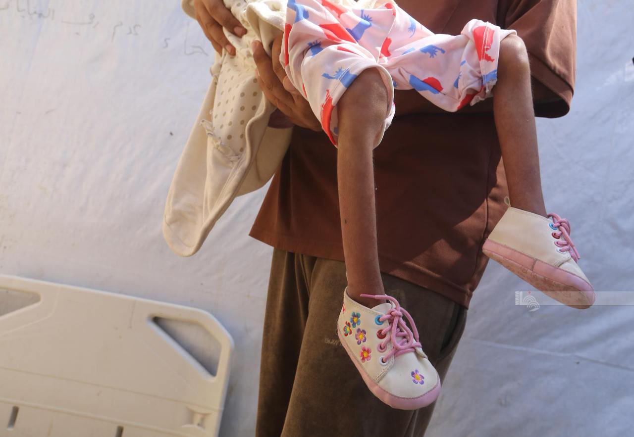 Palestinian Child Dies of Hunger in Gaza Strip