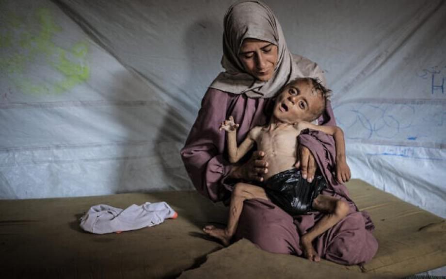 UNICEF Reports Rising Child Malnutrition Crisis in Gaza Strip