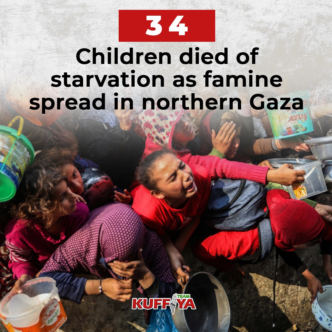 34 Palestinian Children Die from Malnutrition and Dehydration in Gaza