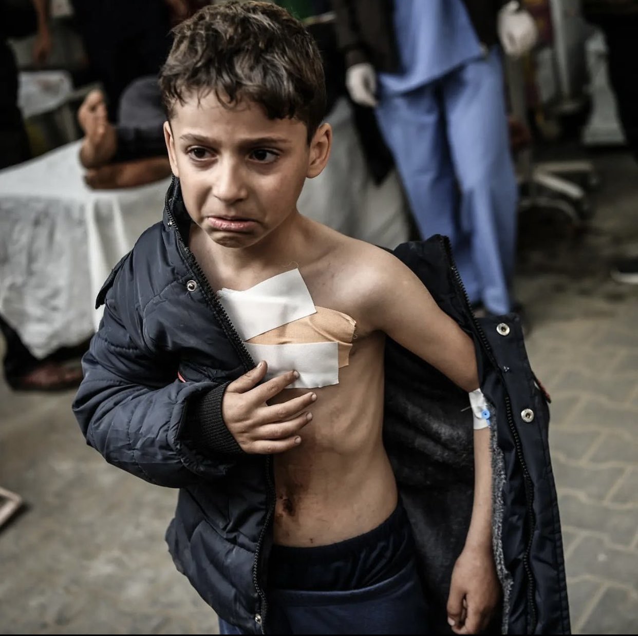 Palestinian Child Injured in Gaza Airstrikes Receives Medical Care