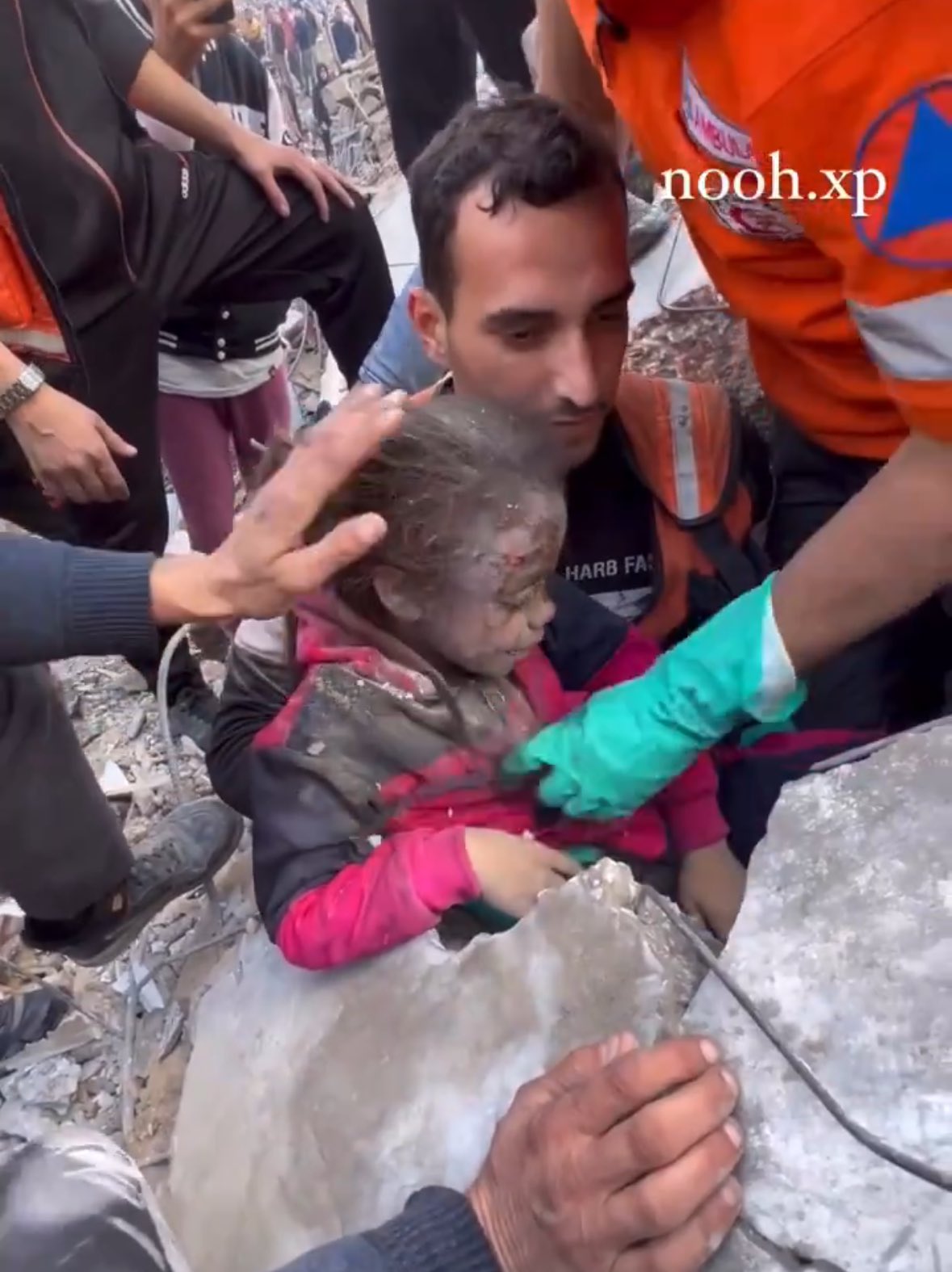 Seven year old girl survives rubble, family sole survivor rescued safely