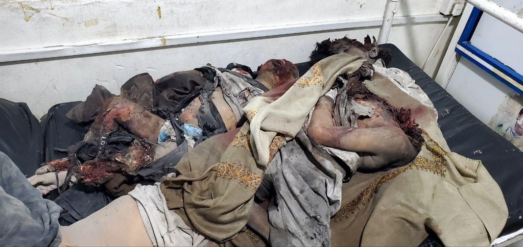 Yemen MoH Reports 39 Deaths from Air Strikes