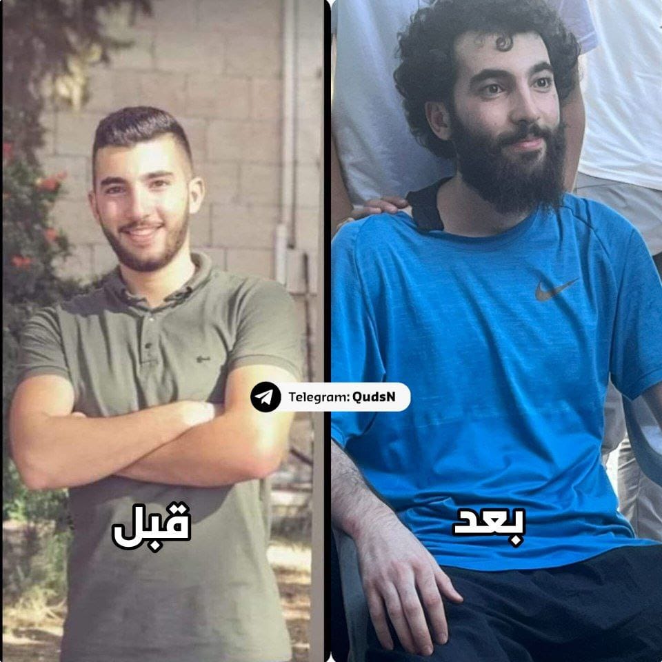 Palestinian Prisoner’s Dramatic Physical Change After 26 Months Detention