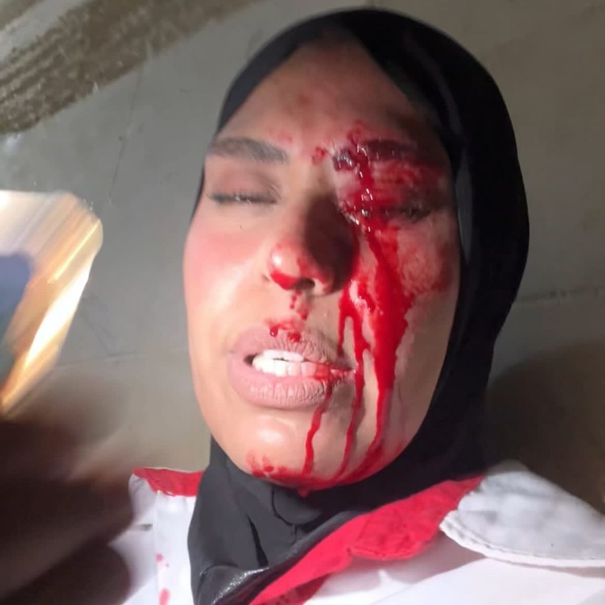 Israeli Military Attacks Palestinian Red Crescent Team in Tulkarem