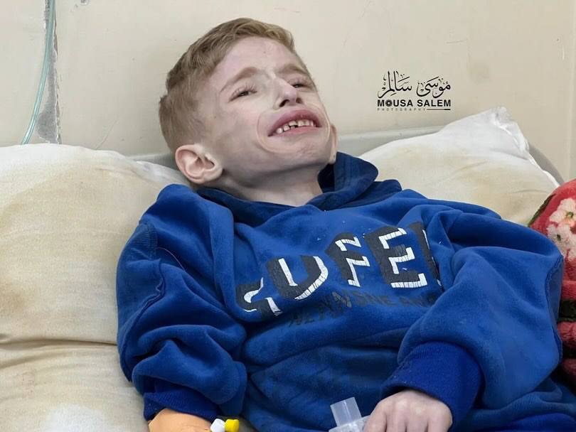 Israel Accused of Starving Children to Death in Gaza