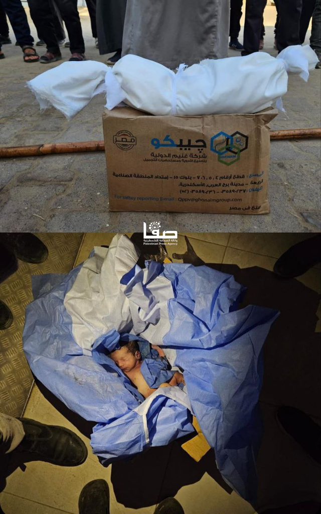 Mother’s Amputation and Infant Death in Conflict Zone