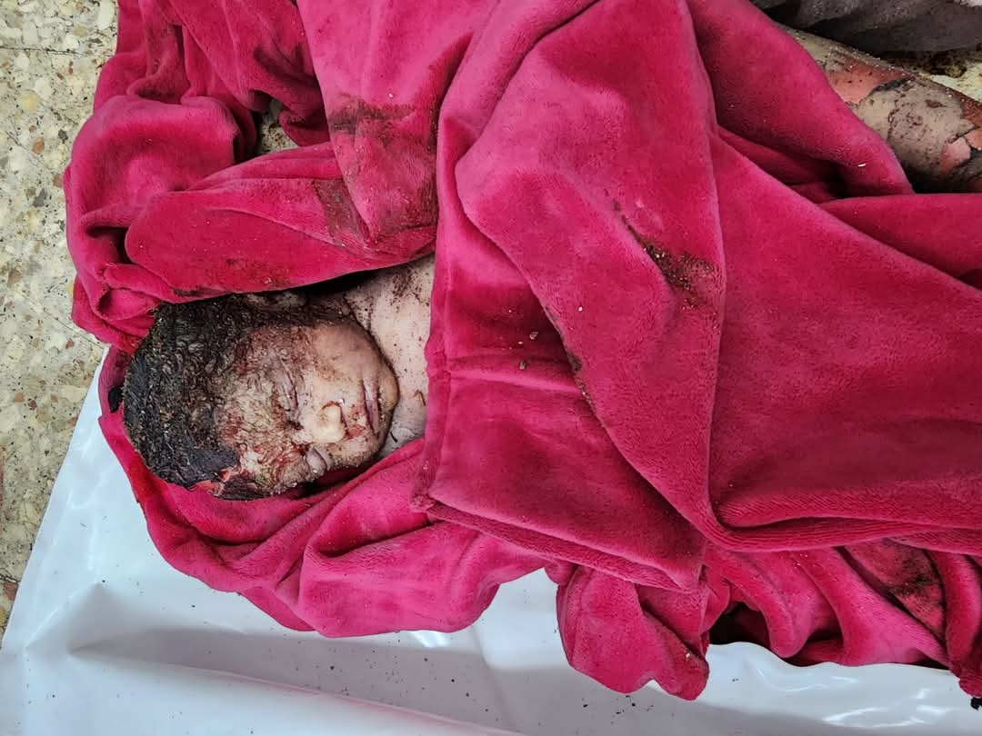 World Killing Children Gaza Genocide Crisis
